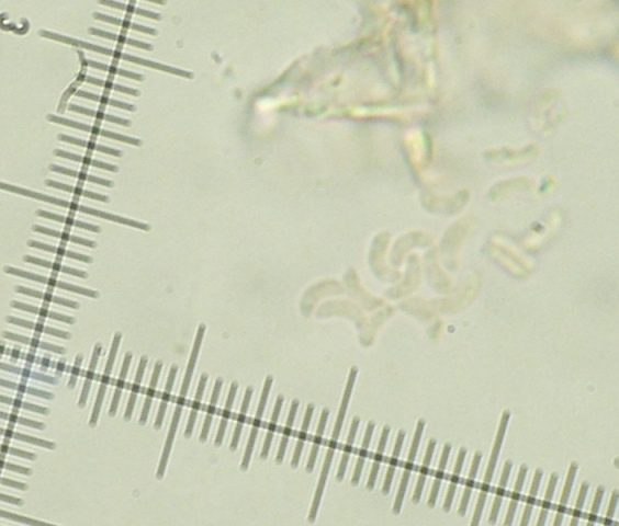 da determinare (Skeletocutis lilacina)